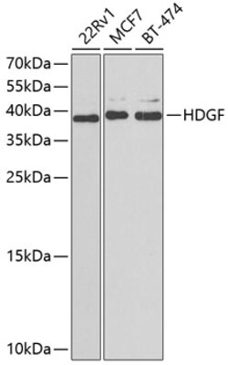 ABclonal Technology&nbsp;HDGF Rabbit pAb
