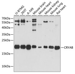 ABclonal Technology&nbsp;CRYAB Rabbit pAb