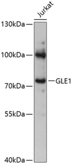 ABclonal Technology&nbsp;GLE1 Rabbit pAb