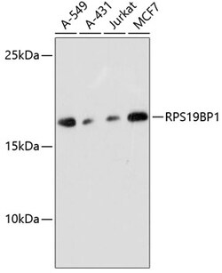 ABclonal Technology&nbsp;RPS19BP1 Rabbit pAb