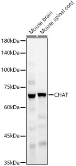 ABclonal Technology&nbsp;CHAT Rabbit pAb