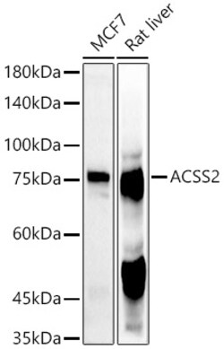 ABclonal Technology ACSS2 Rabbit pAb, Quantity: Each of 1 | Fisher ...