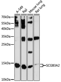 ABclonal Technology SCGB3A2 Rabbit pAb, Quantity: Each of 1 | Fisher ...