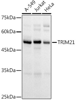 ABclonal Technology&nbsp;TRIM21/SS-A Rabbit pAb