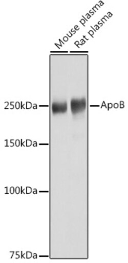 ABclonal Technology ApoB Rabbit pAb, Quantity: Each of 1