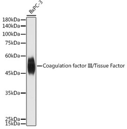 ABclonal Technology&nbsp;Coagulation factor III/Tissue Factor Rabbit pAb