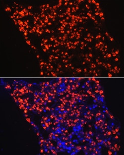 ABclonal Technology&nbsp;Myeloperoxidase (MPO) Rabbit pAb