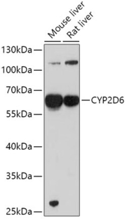 ABclonal Technology&nbsp;CYP2D6 Rabbit pAb