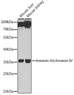 ABclonal Technology&nbsp;Annexin A4/Annexin IV Rabbit pAb
