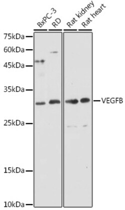 ABclonal Technology&nbsp;VEGFB Rabbit pAb