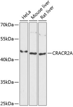 ABclonal Technology&nbsp;CRACR2A Rabbit pAb
