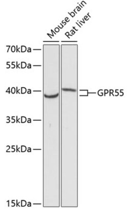 ABclonal Technology&nbsp;GPR55 Rabbit pAb