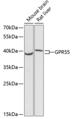 ABclonal Technology&nbsp;GPR55 Rabbit pAb