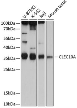 ABclonal Technology&nbsp;CD301/CLEC10A Rabbit pAb