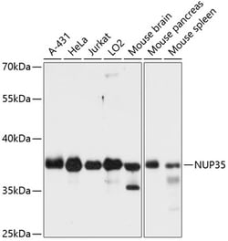 ABclonal Technology&nbsp;NUP35 Rabbit pAb