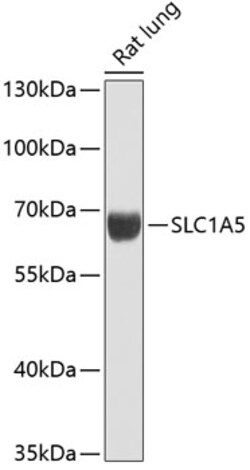 ABclonal Technology&nbsp;SLC1A5 Rabbit pAb