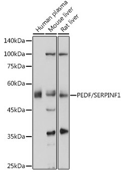 ABclonal Technology&nbsp;PEDF/SERPINF1 Rabbit pAb