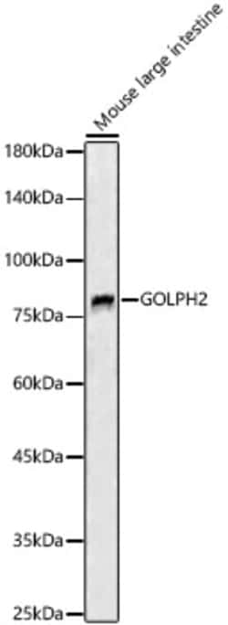 ABclonal Technology&nbsp;GOLPH2 Rabbit pAb