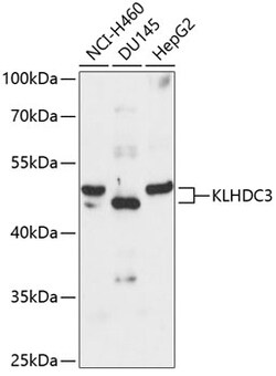 ABclonal Technology&nbsp;KLHDC3 Rabbit pAb