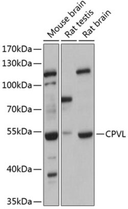 ABclonal Technology&nbsp;CPVL Rabbit pAb