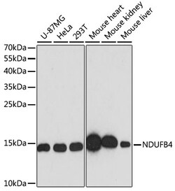 ABclonal Technology&nbsp;[KO Validated] NDUFB4 Rabbit pAb
