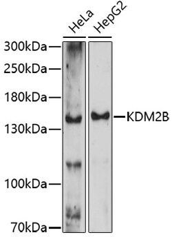 ABclonal Technology&nbsp;KDM2B Rabbit pAb