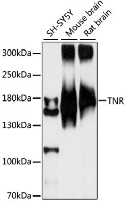 ABclonal Technology&nbsp;TNR Rabbit pAb