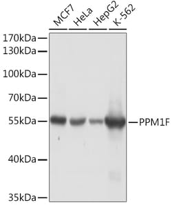 ABclonal Technology&nbsp;PPM1F Rabbit pAb