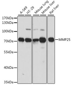 ABclonal Technology&nbsp;MMP25 Rabbit pAb