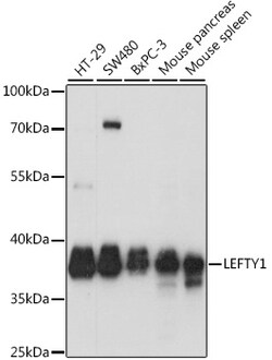 ABclonal Technology&nbsp;LEFTY1 Rabbit pAb
