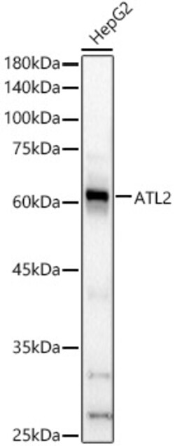 ABclonal Technology&nbsp;ATL2 Rabbit pAb