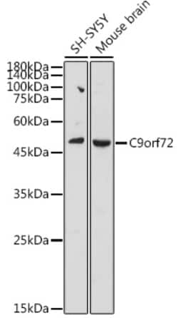ABclonal Technology&nbsp;C9orf72 Rabbit pAb