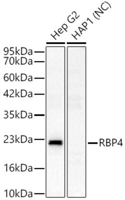 ABclonal Technology&nbsp;RBP4 Rabbit pAb