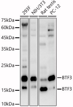 ABclonal Technology&nbsp;BTF3 Rabbit pAb