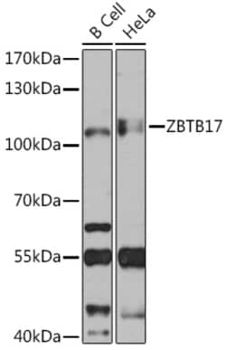 ABclonal Technology&nbsp;ZBTB17 Rabbit pAb