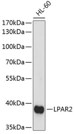 ABclonal Technology&nbsp;LPAR2 Rabbit pAb