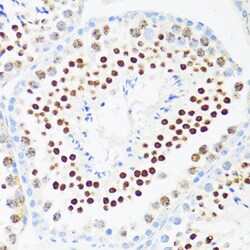 ABclonal Technology&nbsp;DDX21 Rabbit pAb