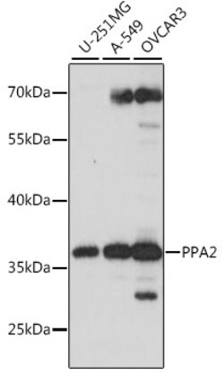ABclonal Technology&nbsp;PPA2 Rabbit pAb