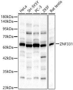 ABclonal Technology&nbsp;ZNF331 Rabbit pAb