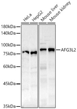 ABclonal Technology&nbsp;AFG3L2 Rabbit pAb