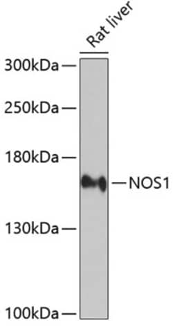 ABclonal Technology&nbsp;NOS1 Rabbit pAb