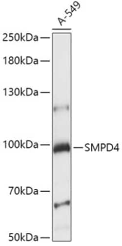 ABclonal Technology&nbsp;SMPD4 Rabbit pAb