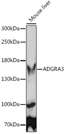 ABclonal Technology&nbsp;ADGRA3 Rabbit pAb