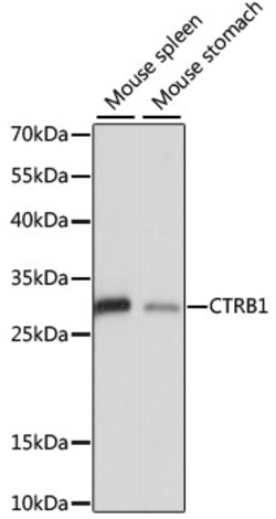 ABclonal Technology&nbsp;CTRB1 Rabbit pAb