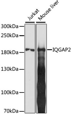ABclonal Technology&nbsp;IQGAP2 Rabbit pAb