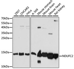 ABclonal Technology&nbsp;[KO Validated] NDUFC2 Rabbit pAb