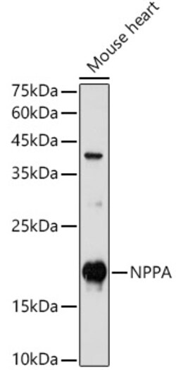 ABclonal Technology&nbsp;NPPA Rabbit pAb