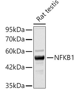 ABclonal Technology&nbsp;NFKB1 Rabbit pAb