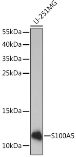 ABclonal Technology&nbsp;S100A5 Rabbit pAb