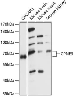 ABclonal Technology&nbsp;CPNE3 Rabbit pAb